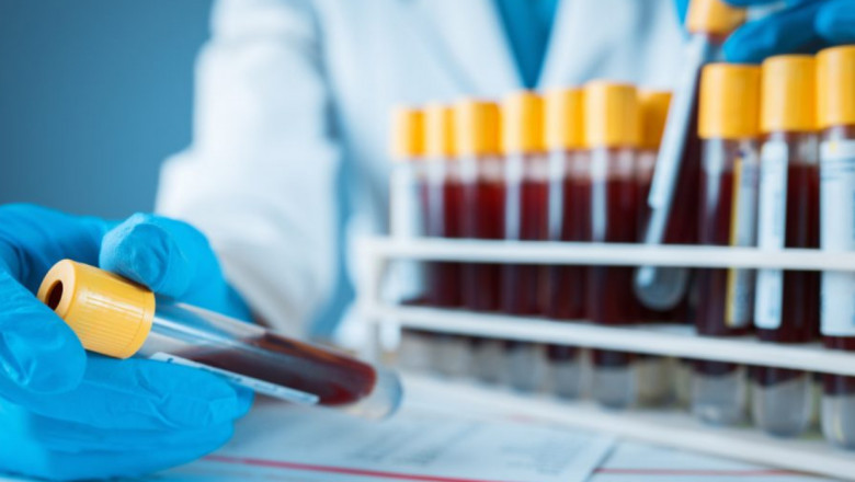 Biomarker is an indicator used to evaluate the health status of an individual