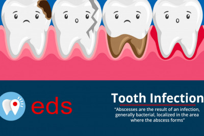 Tooth Infection Treatment | Emergency Dental Service