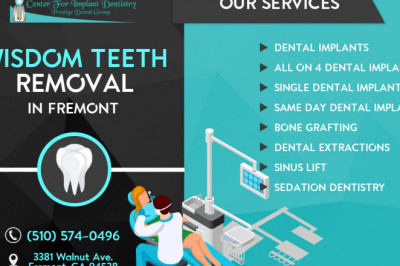 Wisdom teeth removal: A complete guide on the procedure and tips to recovery