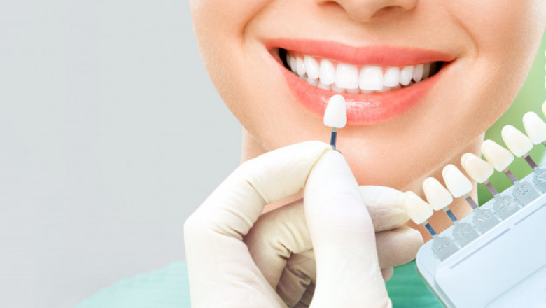 Chips, discoloration, missing, damaged, or misaligned teeth may all be fixed with cosmetic dentistry