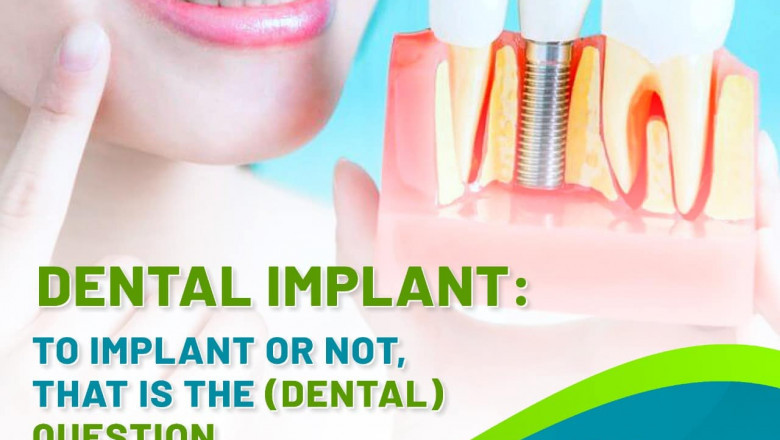 DENTAL IMPLANT : TO IMPLANT OR NOT, THAT IS THE (DENTAL) QUESTION