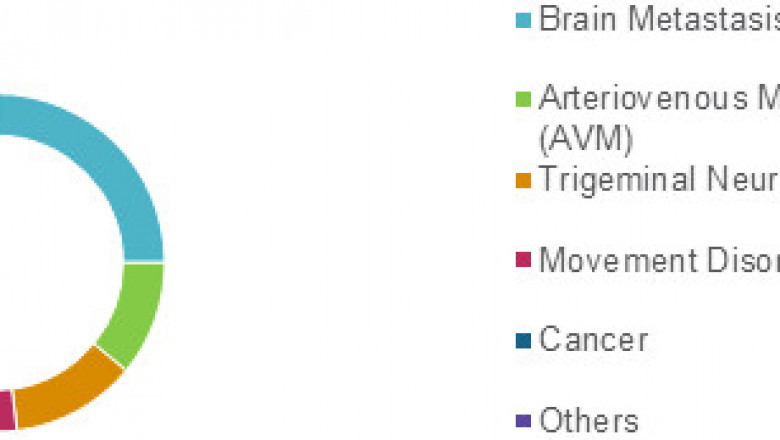 Gamma Knife Market Size, Trends, Shares, Insights and Forecast – 2018-2026