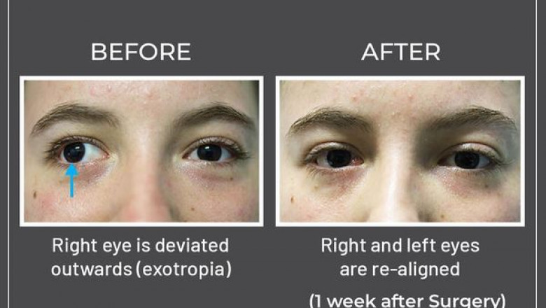 Eye Specialist in Sydney - Contact Dr Parth Shah