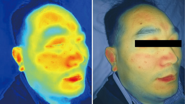 Hyperspectral Imaging Market Forecast Opportunity Analysis - 2026