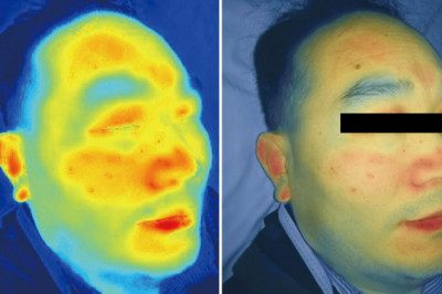 Hyperspectral Imaging Market Forecast Opportunity Analysis - 2026