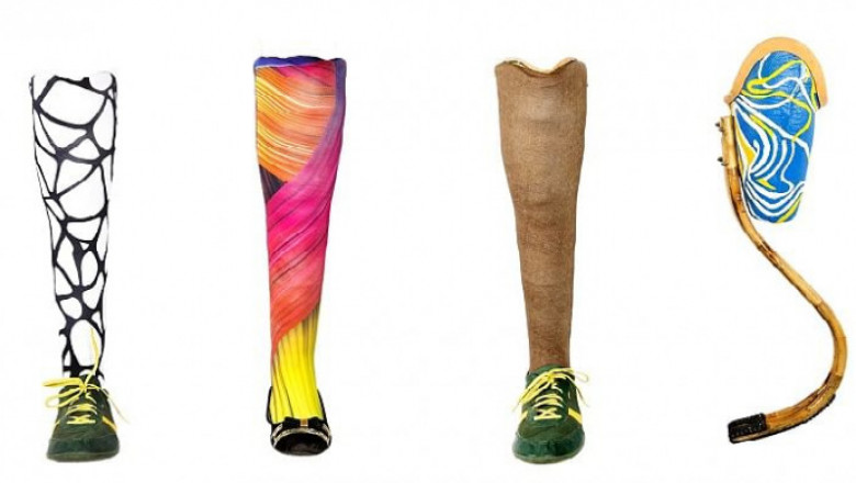 Prosthetic Legs Market Size, Share, Outlook, and Opportunity Analysis, 2018– 2026
