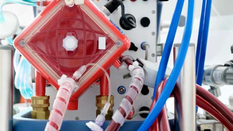 Extracorporeal Membrane Oxygenation System Market is expanding rapidly as Fresenius Medical Care North America