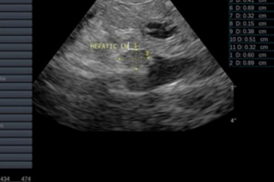 Types of Ultrasound Photos