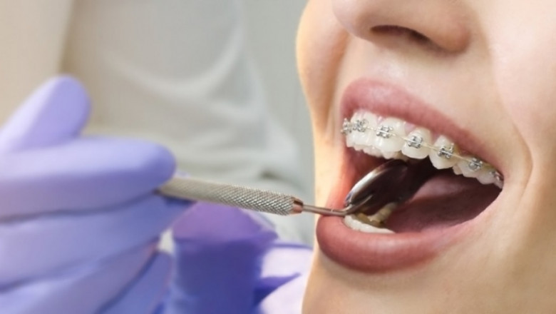 Emergency Dentist Near  Los Angeles, CA 90002 | Emergency Dental Service
