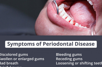 Symptoms of Periodontal Disease | Emergency Dental Service