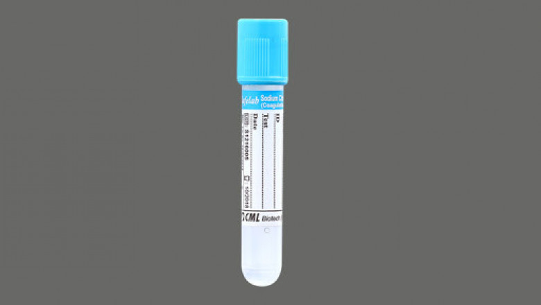 Blood Coagulation Tubes Market Forecast Opportunity Analysis - 2026