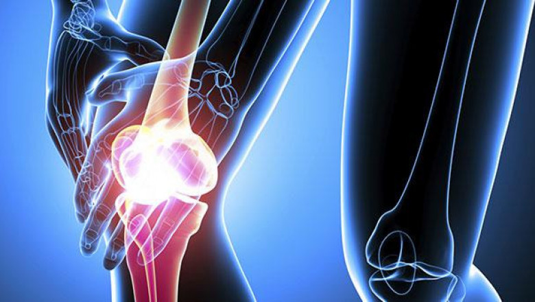 Orthopedic Trauma Devices Market To Reach Beyond US$ 7.7 Billion By 2025 - Coherent Market Insights