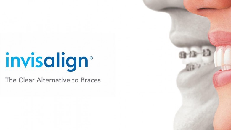 Get the Best Invisalign Treatment at Exquisite Smiles