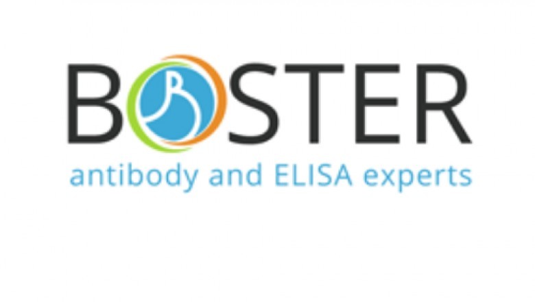 Human Adiponectin Elisa Kit