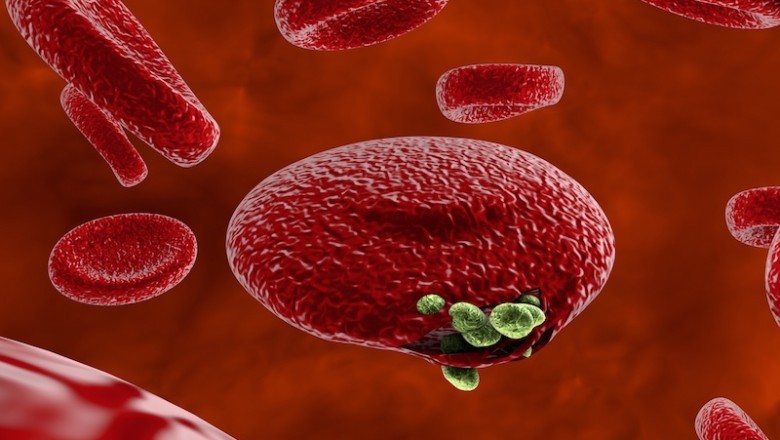 Treatment for Von Willebrand Disease (vWD) is based on the subtype of the disease