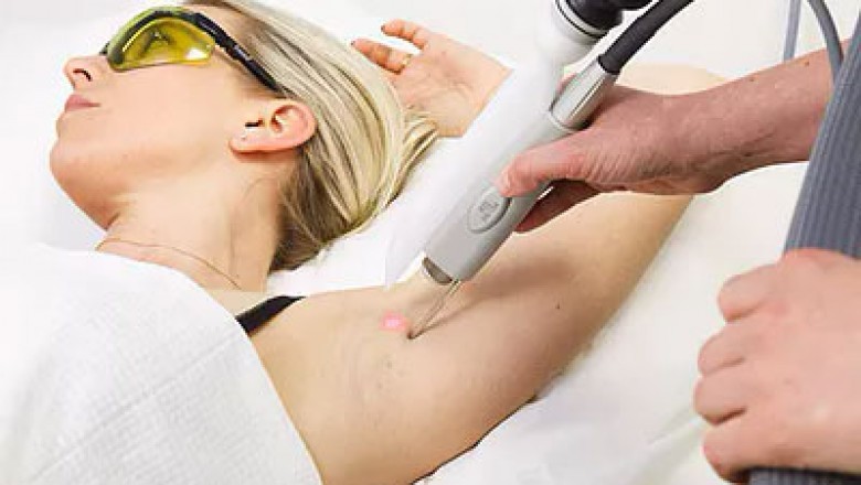 Diverse Sorts of Laser Hair Removal and a few Critical Concerns