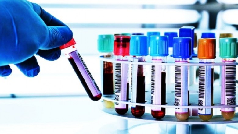 Clinical Laboratory Services Market Size, Trends, Shares, Insights and Forecast – 2020-2027