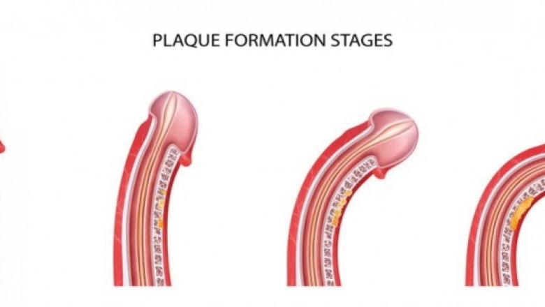 Peyronie’s Disease Treatment Market Size, Trends, Shares, Insights and Forecast – 2018-2026
