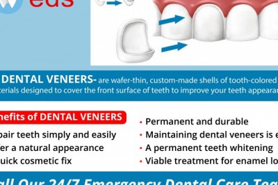 Benefits of Dental Veneers | Emergency Dentist 24/7