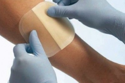 Hemostasis and Tissue Sealing Agents Market keeps on developing with Ethicon LLC presenting SURGICEL fueled absorbable hemostat