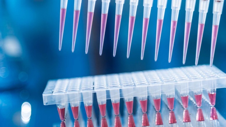 Diagnostic Testing of STDs has proven to be one of the most effective and accurate methods of diagnosing STDs
