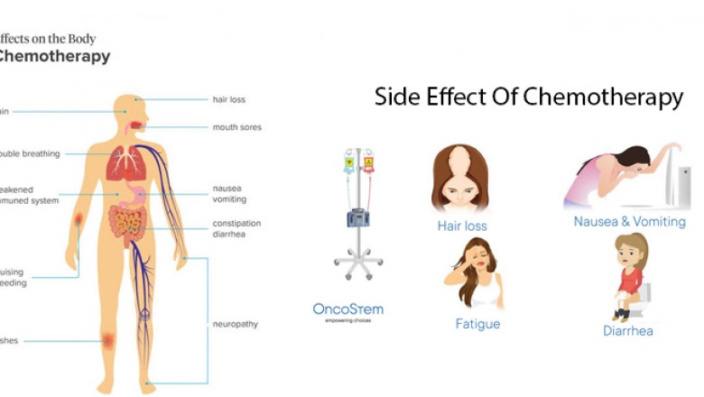 Chemotherapy Doctor & Treatment in Delhi, Gurugram, Gurgaon, Haryana