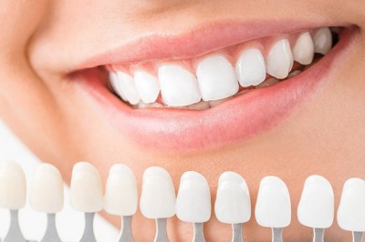 Cosmetic Dentistry Market to Witness 13.50% CAGR during forecast 2018 to 2023 - Exclusive Report by MarketResearchFuture