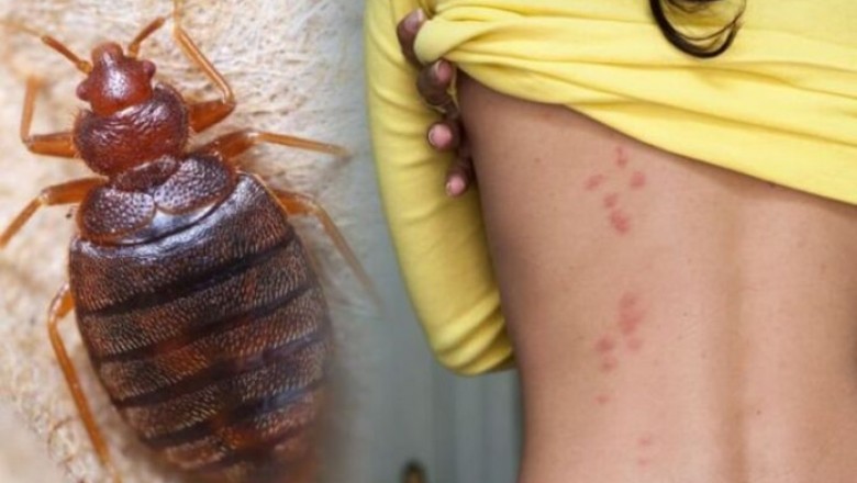 How to get rid of bed bugs: