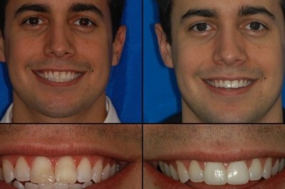 Dentistry Northern Virginia Orthodontics