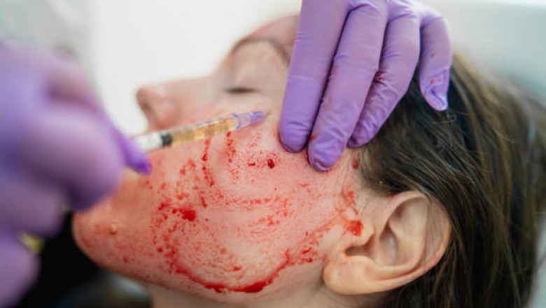 Facial Los Angeles
