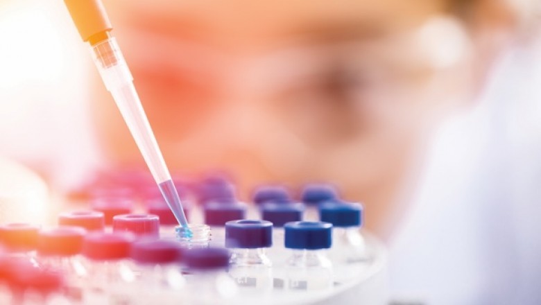 Importance of In Vitro Release Testing in Pharmaceutical Industry - A Short Information