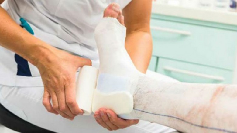India Static Compression Therapy Market Size Share Trends Forecast 2026