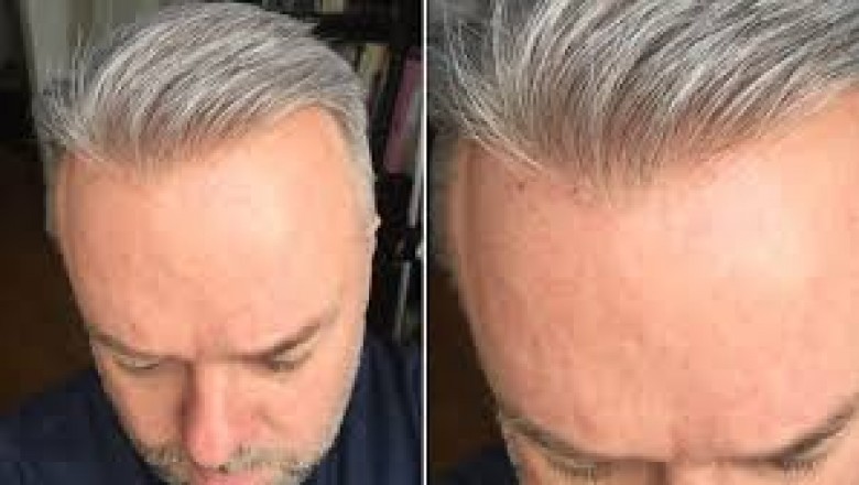 How to buy natural gray hair of wigs