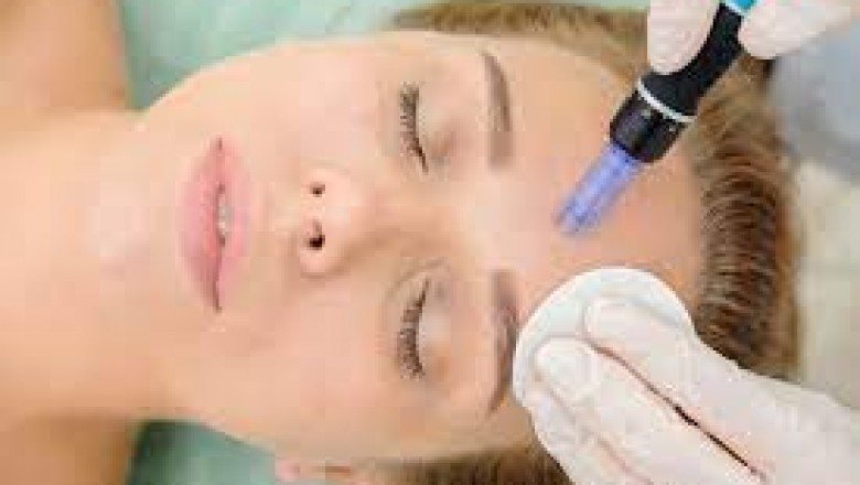 Microneedling facial