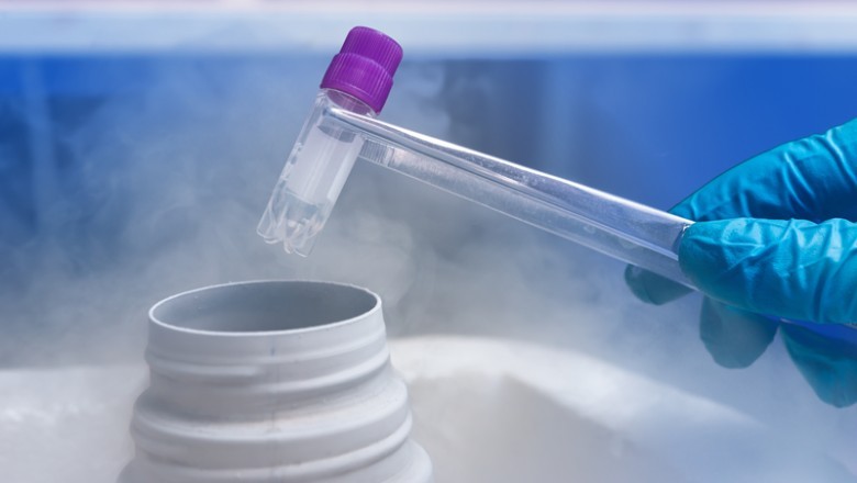 Egg Freezing Cost | Fertility Preservation Clinic Hyderabad