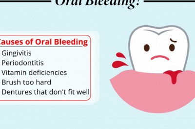 Causes of Oral Bleeding | Best Emergency Dentists