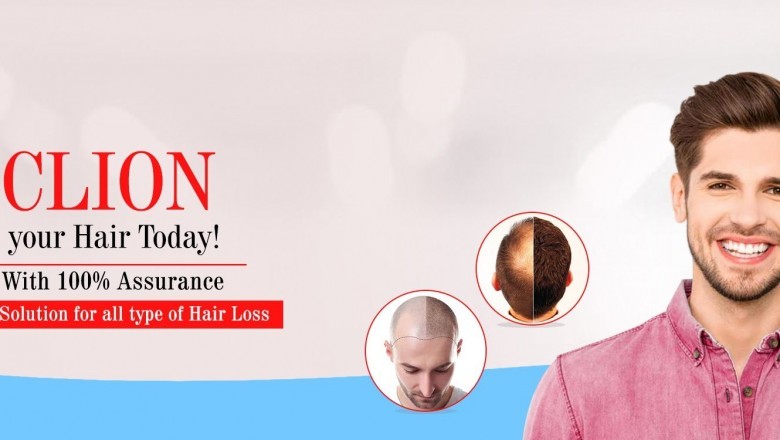 Hair Transplant, Best Hair Transplant, Hair Transplant Clinic in Ahmedabad, Gujarat, India