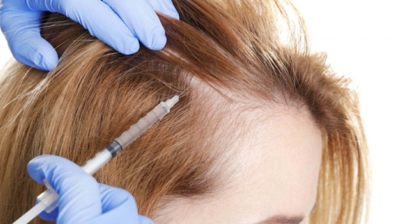The Need For Hair Loss Treatments Is Predicted To Rise As The Incidence Of Alopecia (Hair Loss) Rises