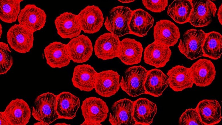 Autologous Stem Cell and Non-Stem Cell Based Therapy market is a novel therapeutic platform growing rapidly in the field of regenerative medicine.