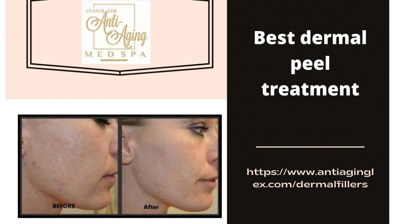 Top 5 Things You Need To Learn Regarding Cosmetic Fillers