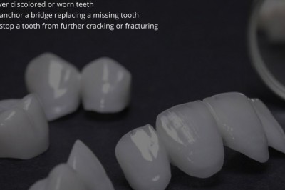 Need of a Dental Crown | Best Emergency Dentists