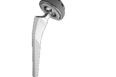 Cementless neck stems are becoming more prominent in orthopaedic surgery as they are often used in hip joint replacement