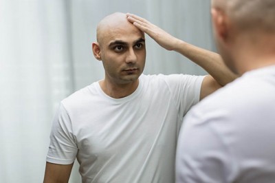Hair Transplantation and Restoration