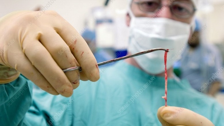 In What Ways May Get Rid Of Affected Veins At Home?