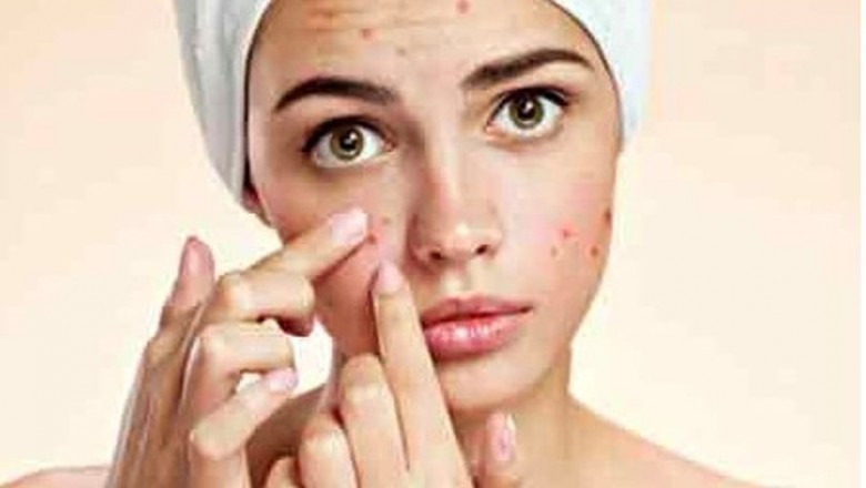 Skin Specialist in Kukatpally | cleoskinclinic