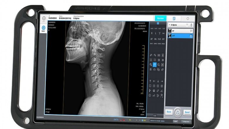 Veterinary Radiography Flat Panel Detector Market Opportunity Analysis-2027