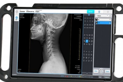 Veterinary Radiography Flat Panel Detector Market Opportunity Analysis-2027