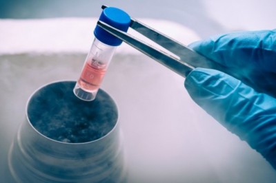 Biobanking Equipment Market Size, Share , Trends and Insights