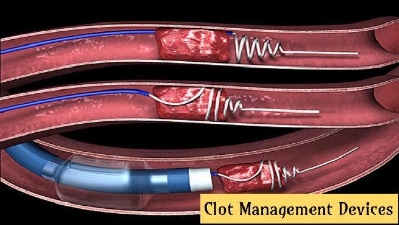 Clot Management Devices Market Size, Trends, Shares, Insights and Forecast – 2018-2026