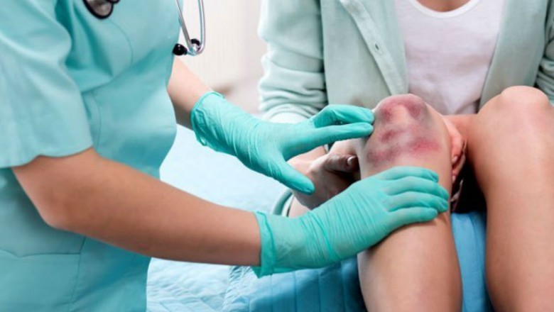 The Middle East and Turkey Immune Thrombocytopenic Purpura (ITP) Treatment Drugs Market Is Witnessing High Demand Owing To the Increase of the Disorder in Children